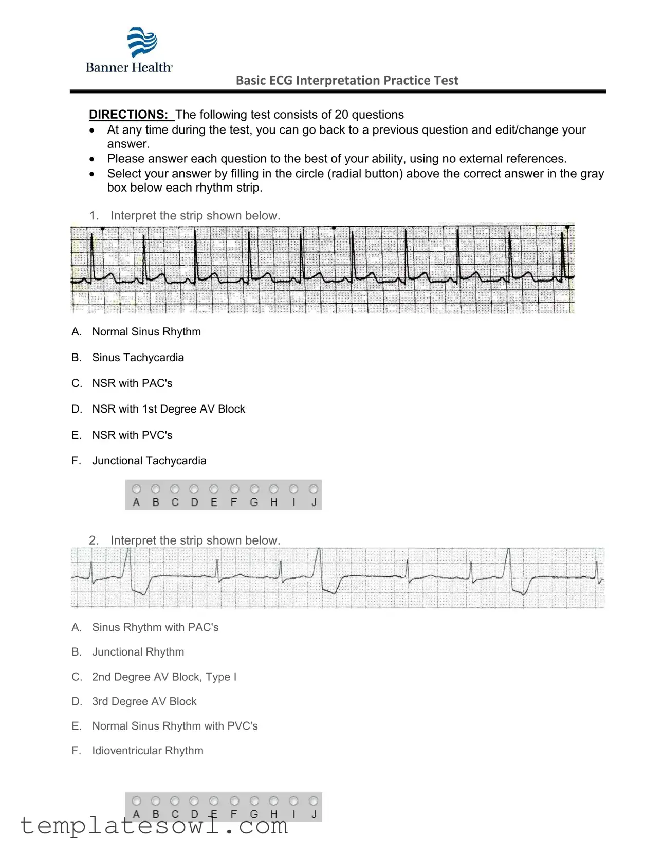 Fill Out Your Ekg Practice Form